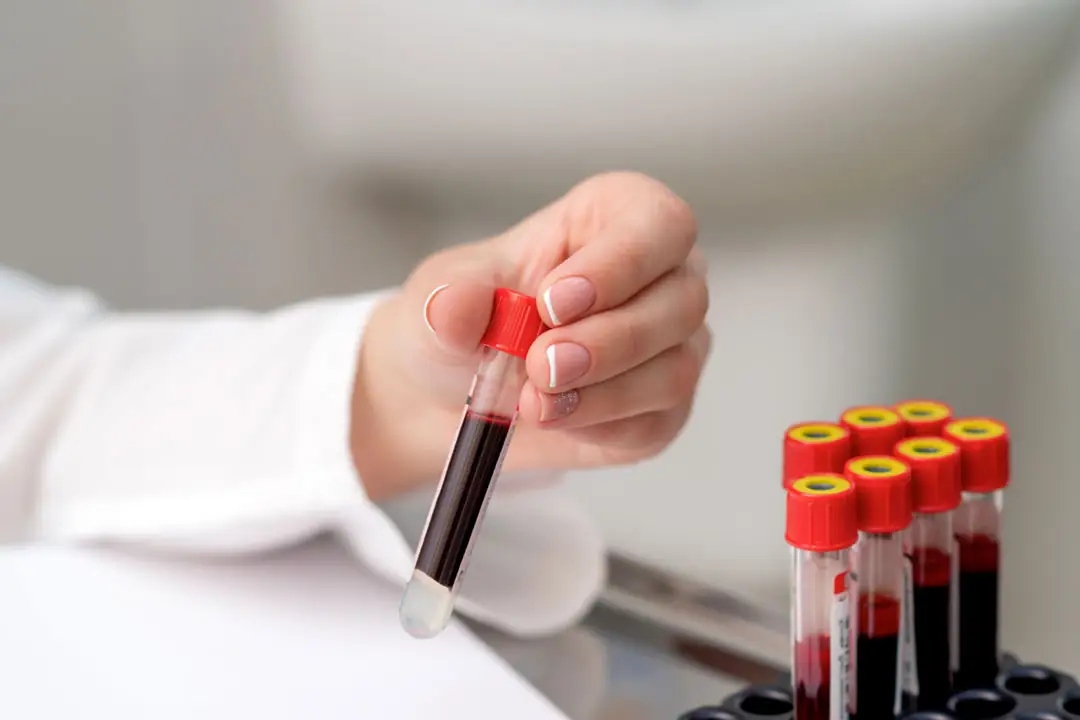 Tubo con sangre para analítica Tubo con sangre para analítica