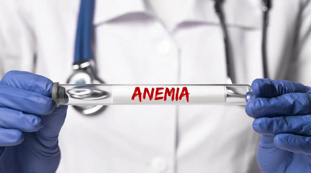 Diagnostico: Anemia Diagnostico: Anemia