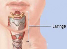 Intervención logopédica en el cáncer de laringe