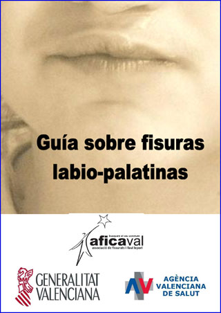 Guía sobre fisuras labio-palatinas